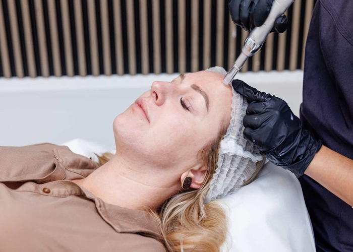 Botox Treatment